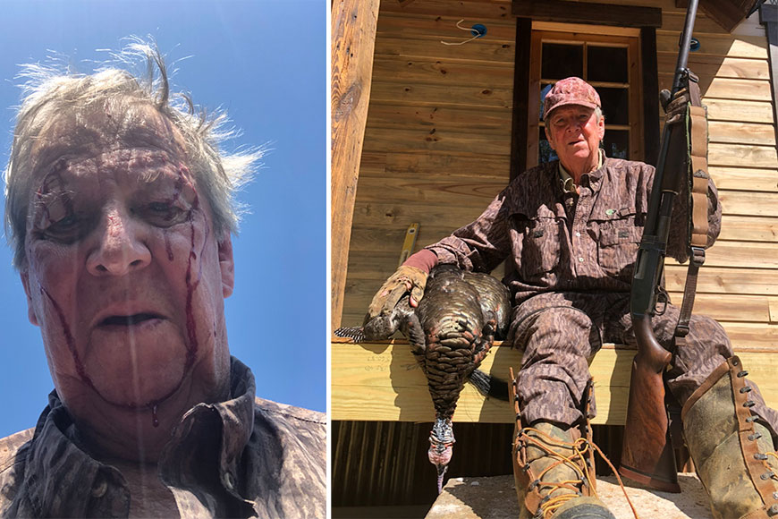 82-Year-Old Turkey Hunter Attacked by Bobcat Tells the Story