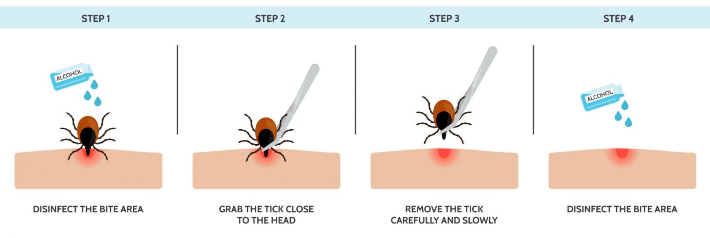 illustration of how to remove a tick
